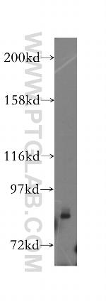 DBC1 Antibody in Western Blot (WB)
