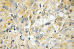 DBC1 Antibody in Immunohistochemistry (Paraffin) (IHC (P))