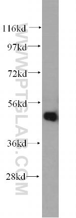 Antizyme inhibitor 1 Antibody in Western Blot (WB)
