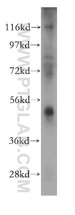 Antizyme inhibitor 1 Antibody in Western Blot (WB)