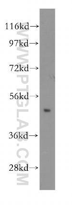Antizyme inhibitor 1 Antibody in Western Blot (WB)