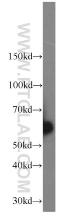CAMKK2 Antibody in Western Blot (WB)
