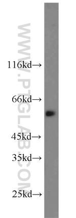 CAMKK2 Antibody in Western Blot (WB)