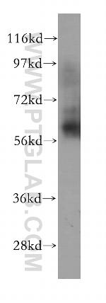 CAMKK2 Antibody in Western Blot (WB)