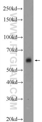 CAMKK2 Antibody in Western Blot (WB)