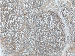 CAMKK2 Antibody in Immunohistochemistry (Paraffin) (IHC (P))