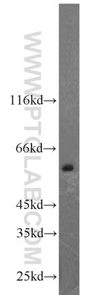 CAMKK2 Antibody in Western Blot (WB)