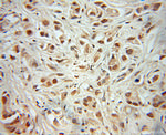 MEIS2 Antibody in Immunohistochemistry (Paraffin) (IHC (P))