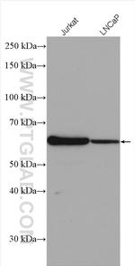 MEIS2 Antibody in Western Blot (WB)