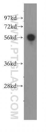 SLA/LP Antibody in Western Blot (WB)