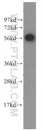 SLA/LP Antibody in Western Blot (WB)