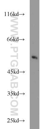 CHRNB1 Antibody in Western Blot (WB)