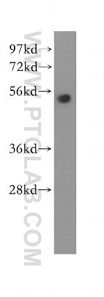 Cyclin E1 Antibody in Western Blot (WB)