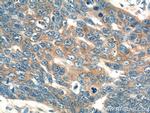 FBXL18 Antibody in Immunohistochemistry (Paraffin) (IHC (P))