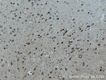 WFS1 Antibody in Immunohistochemistry (Paraffin) (IHC (P))