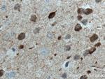 WFS1 Antibody in Immunohistochemistry (Paraffin) (IHC (P))