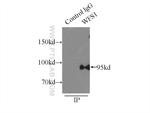 WFS1 Antibody in Immunoprecipitation (IP)