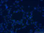 AGTRAP Antibody in Immunocytochemistry (ICC/IF)