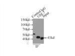 BMSC UbP Antibody in Immunoprecipitation (IP)