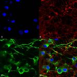 K+/Cl-Cotransporter (KCC2) Antibody in Immunocytochemistry (ICC/IF)