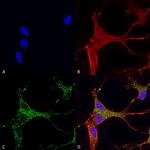 Cav3.1 Ca+2 Channel Antibody in Immunocytochemistry (ICC/IF)