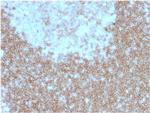 CD268/BAFFR/TNFRSF13C Antibody in Immunohistochemistry (Paraffin) (IHC (P))