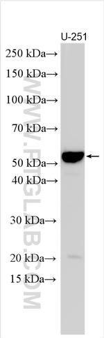 CRLF3 Antibody in Western Blot (WB)