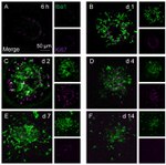 Ki-67 Antibody in Immunohistochemistry (IHC)
