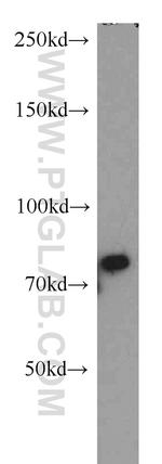 FUS/TLS Antibody in Western Blot (WB)