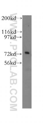 FUS/TLS Antibody in Western Blot (WB)