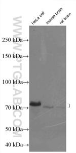 FUS/TLS Antibody in Western Blot (WB)
