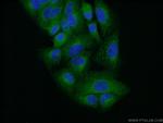 TRK fused gene Antibody in Immunocytochemistry (ICC/IF)