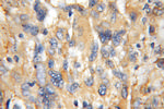 TRK fused gene Antibody in Immunohistochemistry (Paraffin) (IHC (P))