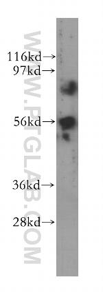 TRK fused gene Antibody in Western Blot (WB)