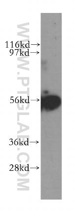 TRK fused gene Antibody in Western Blot (WB)