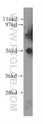 TRK fused gene Antibody in Western Blot (WB)