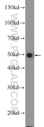 TRK fused gene Antibody in Western Blot (WB)