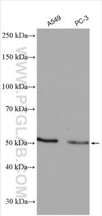 TRK fused gene Antibody in Western Blot (WB)