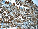 PSMA6 Antibody in Immunohistochemistry (Paraffin) (IHC (P))