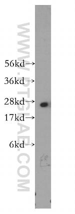 PSMA6 Antibody in Western Blot (WB)
