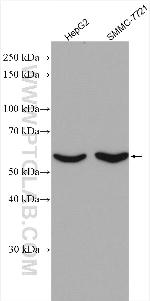 MPP6 Antibody in Western Blot (WB)