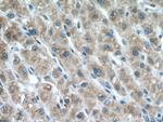 LIAS Antibody in Immunohistochemistry (Paraffin) (IHC (P))
