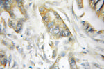 SCIN Antibody in Immunohistochemistry (Paraffin) (IHC (P))