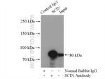 SCIN Antibody in Immunoprecipitation (IP)