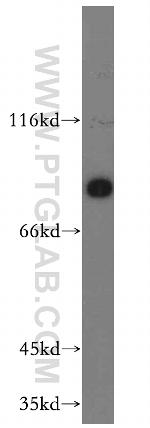 SCIN Antibody in Western Blot (WB)