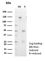 Creatine Kinase MM (Biomarker for Muscular Injury & Cardiac Damage) Recombinant Rabbit Monoclonal Antibody (CKMM/13033R)