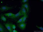 TNS4 Antibody in Immunocytochemistry (ICC/IF)