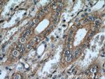 PLSCR1 Antibody in Immunohistochemistry (Paraffin) (IHC (P))