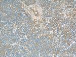 PLSCR1 Antibody in Immunohistochemistry (Paraffin) (IHC (P))