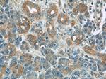 PLSCR1 Antibody in Immunohistochemistry (Paraffin) (IHC (P))